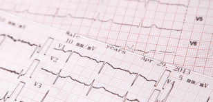 ECG Registry