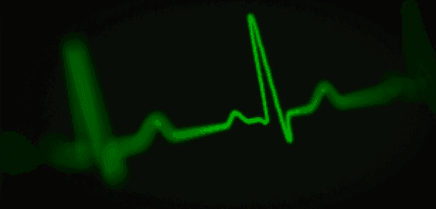 LYDUS ECG